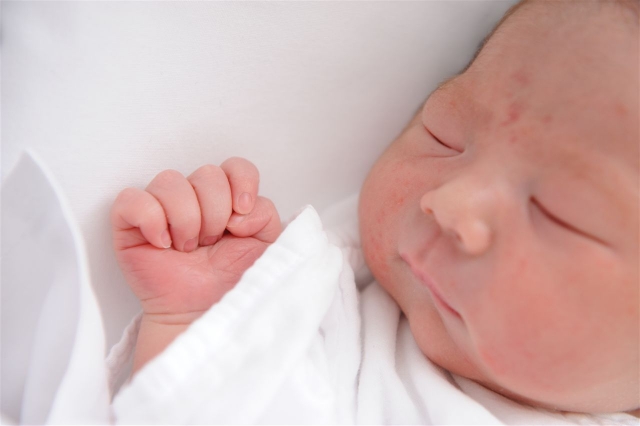 乳児湿疹に悩む母親がするべきこと。病院に頼るだけより見極める力を育てる